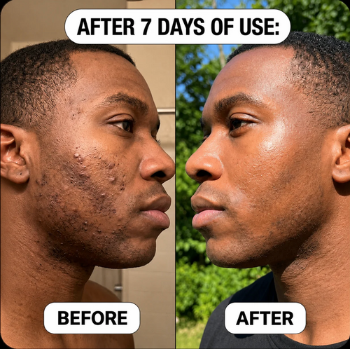 Verena Skin Bump Smoothing & Relief Solution